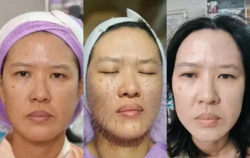 Pasien Susan Health & Beauty Center 02