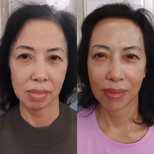 Pasien Susan Health & Beauty Center 03