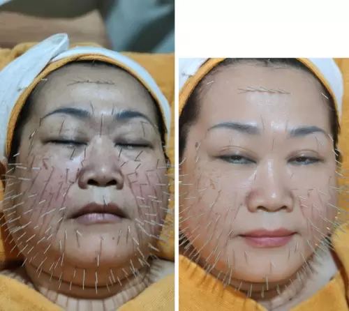 Pasien Susan Health & Beauty Center 05