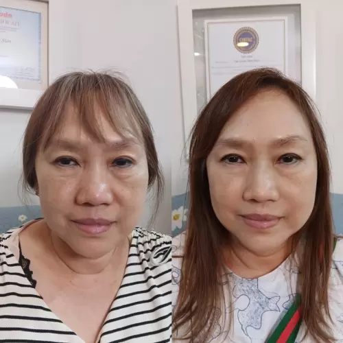 Pasien Susan Health & Beauty Center 09