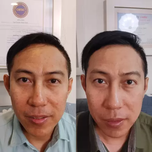 Pasien Susan Health & Beauty Center 12