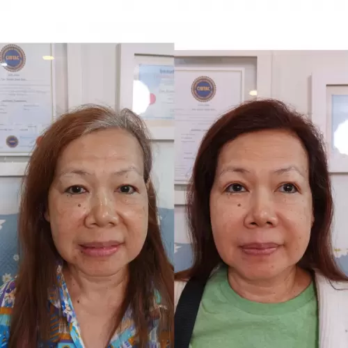 Pasien Susan Health & Beauty Center 15